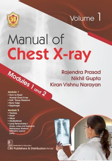 Image of - Manual Of Chest Xray Modules 1 And 2 Vol 1 | Paperback
