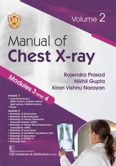 Image of - Manual Of Chest Xray Modules 3 And 4 Vol 2 | Paperback