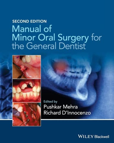 Image of - Manual of Minor Oral Surgery for the General Dentist | 2nd Edition | Hardcover