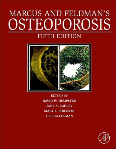 Image of - Marcus And Feldmans Osteoporosis 5th Edition 2 Vol Set | Hardcover