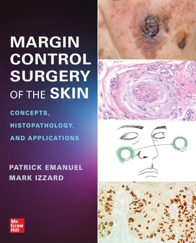 Image of - Margin Control Surgery Of The Skin Concepts Histopathology And Applications | Paperback
