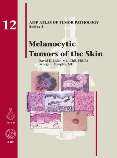 Image of - Melanocytic Tumors of the Skin 12 | Hardcover