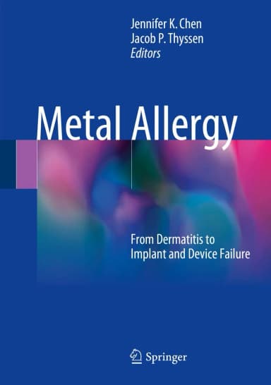 Image of - Metal Allergy From Dermatitis to Implant and Device Failure | Hardcover