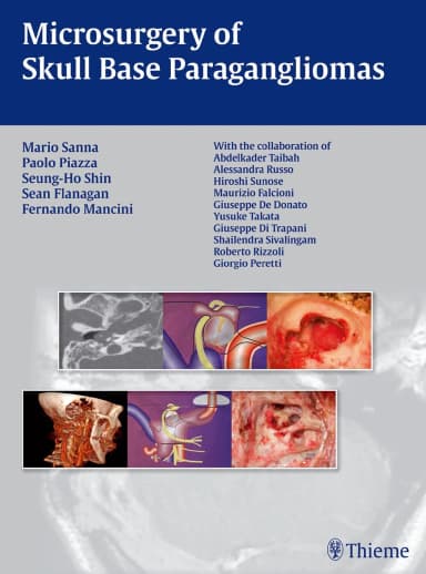 Image of - Microsurgery of Skull Base Paragangliomas | Hardcover