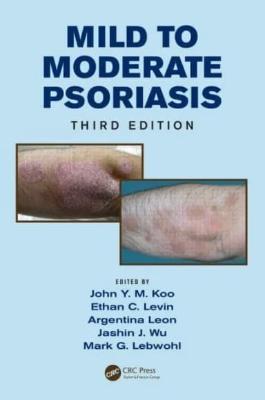 Image of - Mild to Moderate Psoriasis | Third Edition | Hardcover