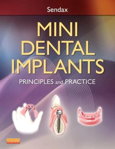 Image of - Mini Dental Implants Principles and Practice | Hardcover