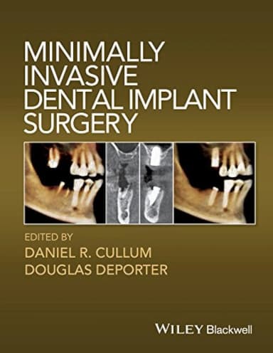 Image of - Minimally Invasive Dental Implant Surgery | Hardcover