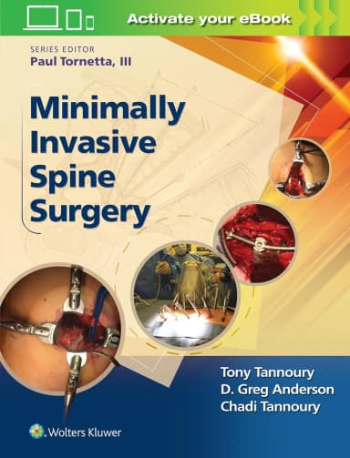 Image of - Minimally Invasive Spine Surgery | Hardcover