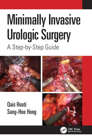 Image of - Minimally Invasive Urologic Surgery A Step By Step Guide | Paperback