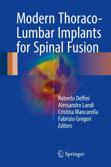 Image of - Modern Thoraco-Lumbar Implants for Spinal Fusion | Hardcover