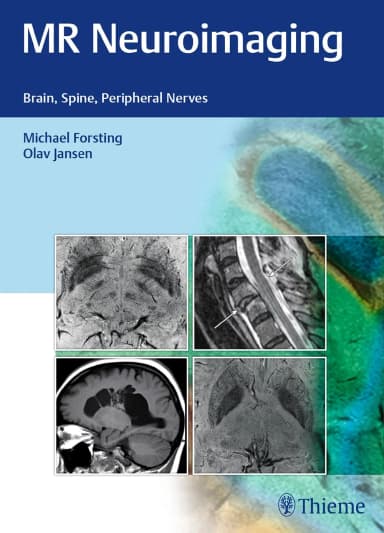 Image of - MR Neuroimaging | Hardcover