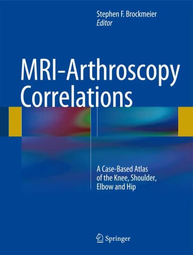 Image of - MRI-Arthroscopy Correlations | Hardcover