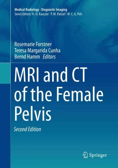 Image of - MRI and CT of the Female Pelvis | 2nd Edition | Paperback