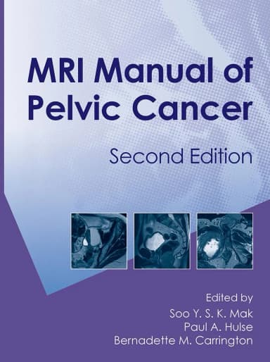 Image of - MRI Manual of Pelvic Cancer | 2nd Edition | Hardcover