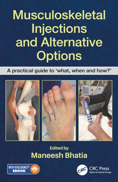 Image of - Musculoskeletal Injections and Alternative Options | Paperback