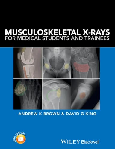 Image of - Musculoskeletal X Rays For Medical Students and Trainees | Paperback