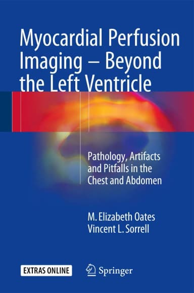 Image of - Myocardial Perfusion Imaging- Beyond the Left Ventricle | Hardcover