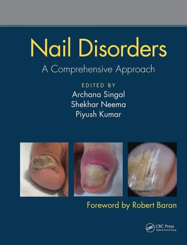 Image of - Nail Disorders A Comprehensive Approach | Hardcover