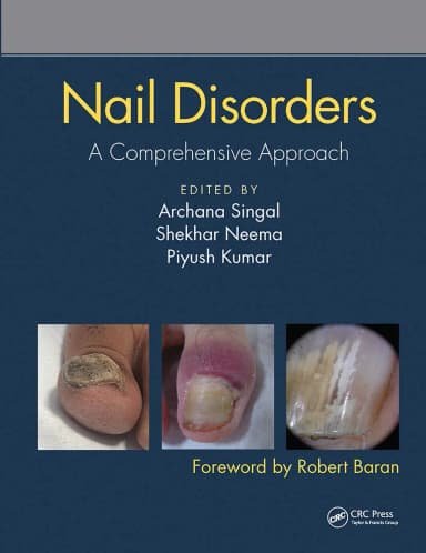 Image of - Nail Disorders A Comprehensive Approach | Paperback