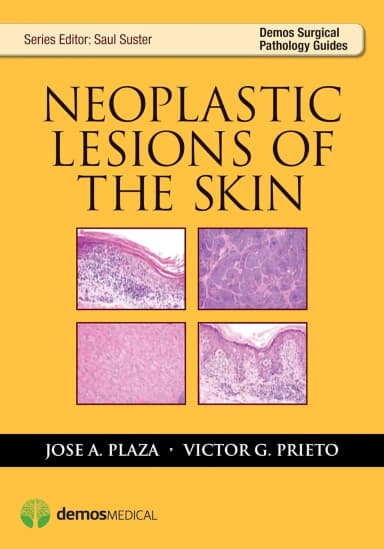 Image of - Neoplastic Lesions of the Skin | Paperback