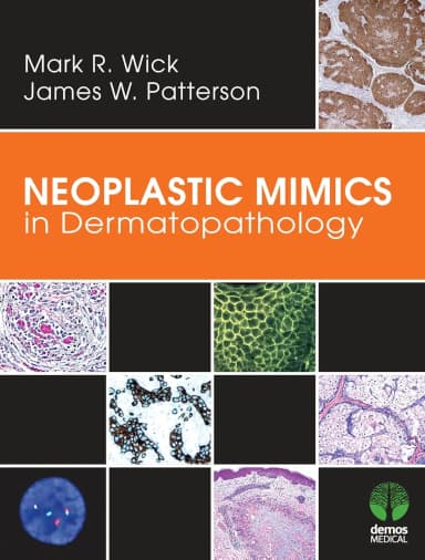Image of - Neoplastic MIMICS in Dermatopathology | Hardcover