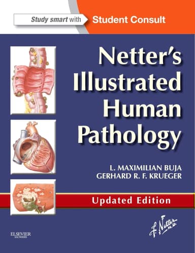 Image of - Netter's Illustrated Human Pathology | Paperback