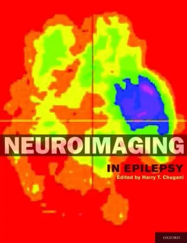 Image of - Neuroimaging in Epilepsy | Hardcover