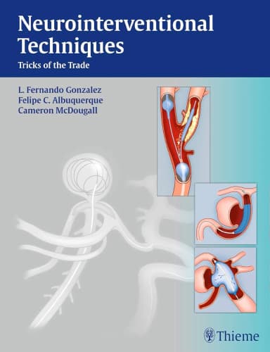 Image of - Neurointerventional Techniques Tricks of the Trade | Hardcover