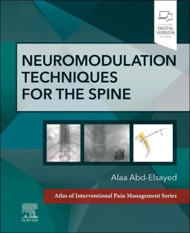 Image of - Neuromodulation Techniques For The Spine | Hardcover