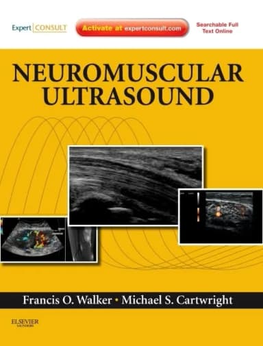 Image of - Neuromuscular Ultrasound | Hardcover