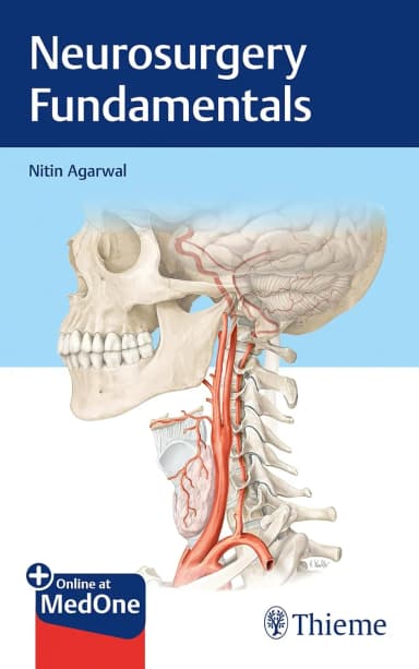 Image of - Neurosurgery Fundamentals | Paperback