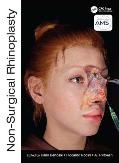 Image of - Non Surgical Rhinoplasty | Hardcover