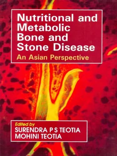 Image of - Nutritional and Metabolic Bone and Stone Disease An Asian Perspective | Hardcover