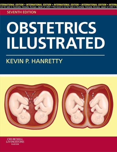 Image of - Obstetrics Illustrated IE | Paperback