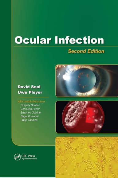 Image of - Ocular Infection | 2nd Edition | Hardcover