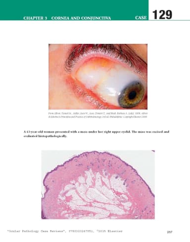 Image of - Ocular Pathology Case Reviews | Paperback