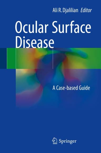 Image of - Ocular Surface Disease | Hardcover