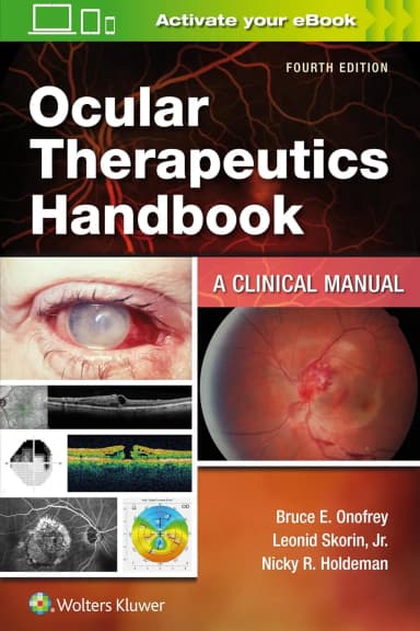 Image of - Ocular therapeutics Handbook A Clinical Manual | 4th Edition | Paperback