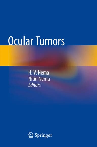 Image of - Ocular Tumors | Paperback