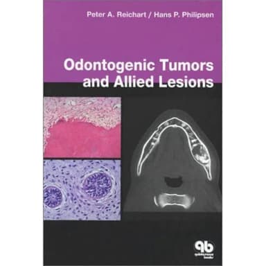 Image of - Odontogenic Tumors and Allied Lesions | Hardcover