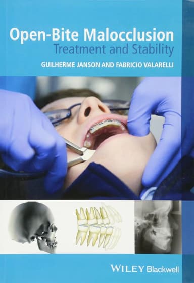 Image of - Open-Bite Malocclusion Treatment and Stabiligy | Paperback