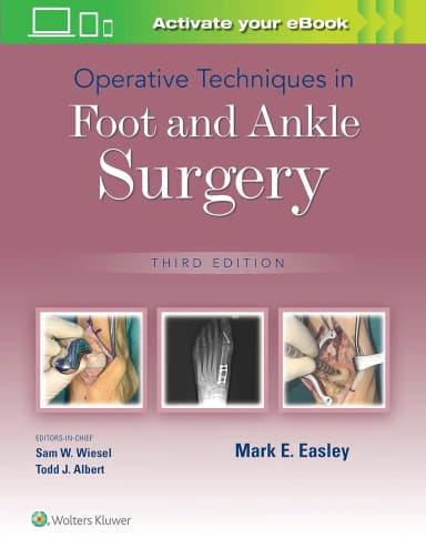 Image of - Operative Techniques In Foot And Ankle Surgery Third Edition | Hardcover