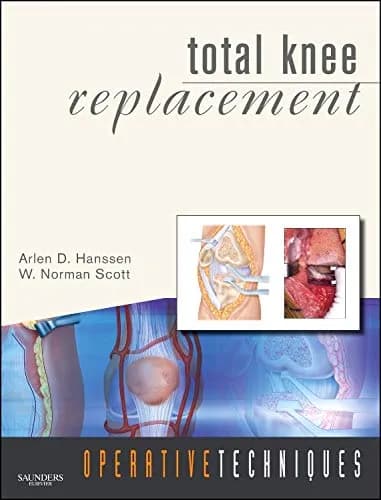 Image of - Operative Techniques Total Knee Replacement | With DVD | Hardcover