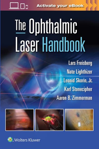 Image of - The Ophthalmic Laser Handbook | Paperback