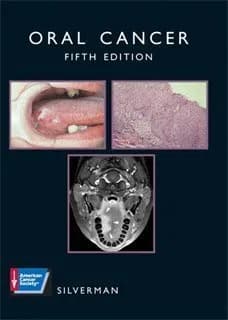 Image of - Oral Cancer | 5th Edition With CD | Hardcover