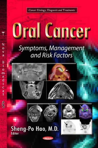 Image of - Oral Cancer Symptoms | Management and Risk Factors | Hardcover