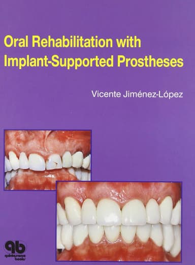 Image of - Oral Rehabilitation with Implant-Supported Prostheses | Hardcover