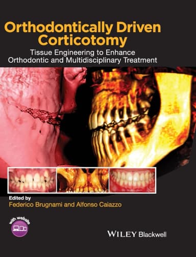 Image of - Orthodontically Driven Corticotomy | Hardcover
