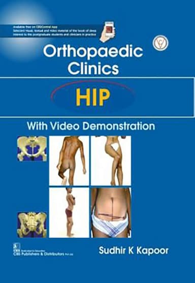 Image of - Orthopaedic Clinics HIP with Video Demonstration | Hardcover