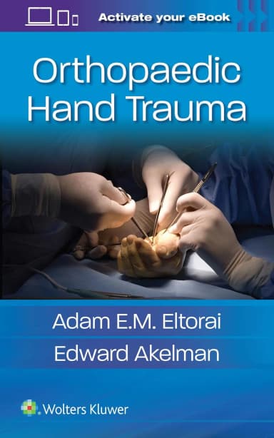 Image of - Orthopaedic Hand Trauma | Paperback